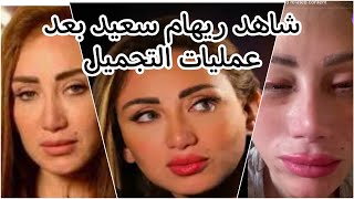 بالفيديو التجميل شوه ريهام سعيد