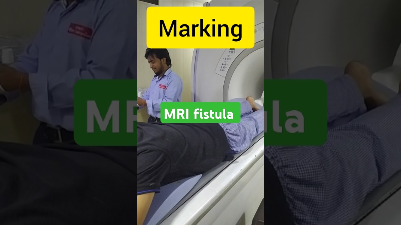 MRI Fistulogram scan for Perianal region fistula.piles 