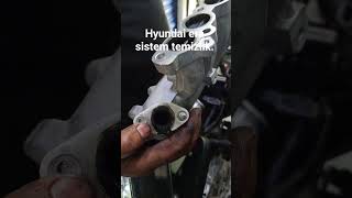 Hyundai Era Kurum Temizlik.