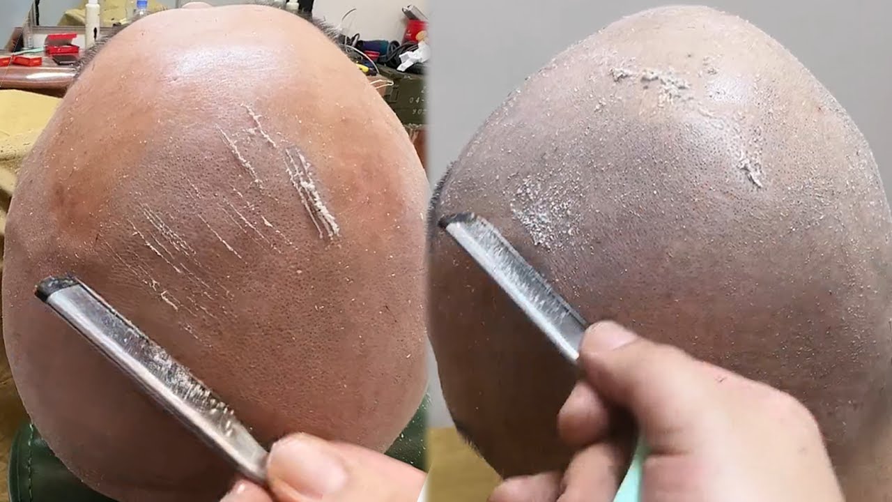 💈Removes a lot of dead skin from a man's head and face.  🪒 Sharp but harmless! Top master shaving!
