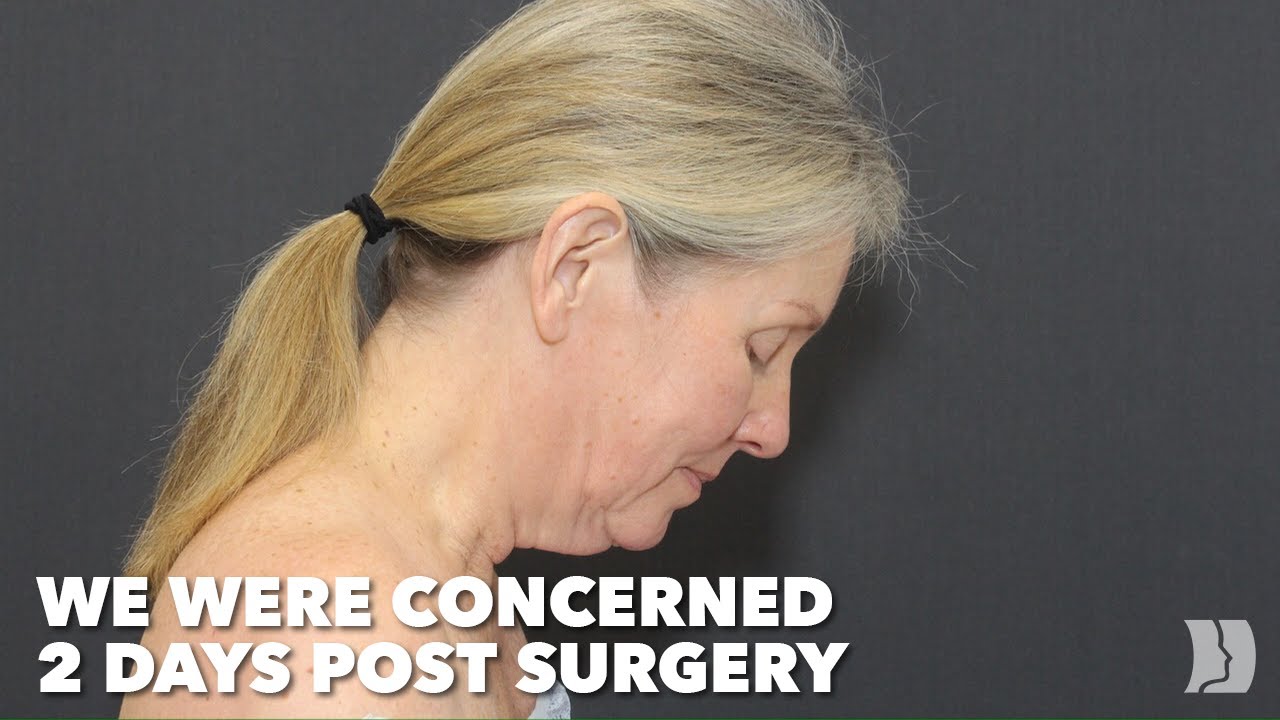 She Waited 6 Months After Surgery To Show Her Face