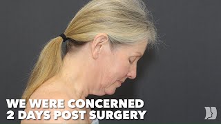 6 Months Later, She Finally Showed Her Face – Barbara's Full Reveal