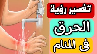 تفسير رؤية الحرق فى المنام | رؤية حرق اليد والرجل والوجه فى المنام