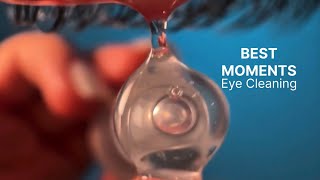 Eye Cleaning Best Moments (1 Hour ASMR)