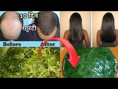 धनिये का ये प्रयोग झड़ते बालों का इलाज  | धनिया गंजेपन का इलाज - सिर्फ धनिया का पत्ता For Hair Fall
