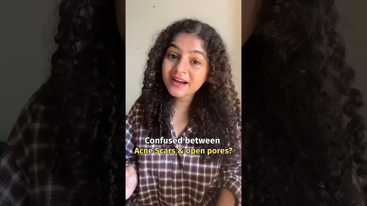 How to treat Acne Scars & Open Pores? #skincare #aesthetician #youtubeshorts