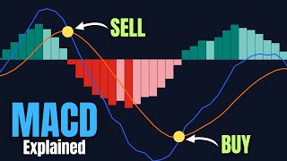 Celebrity Most Traders Use MACD Wrong 😳 Here’s the Right Way to Trade It Net Worth