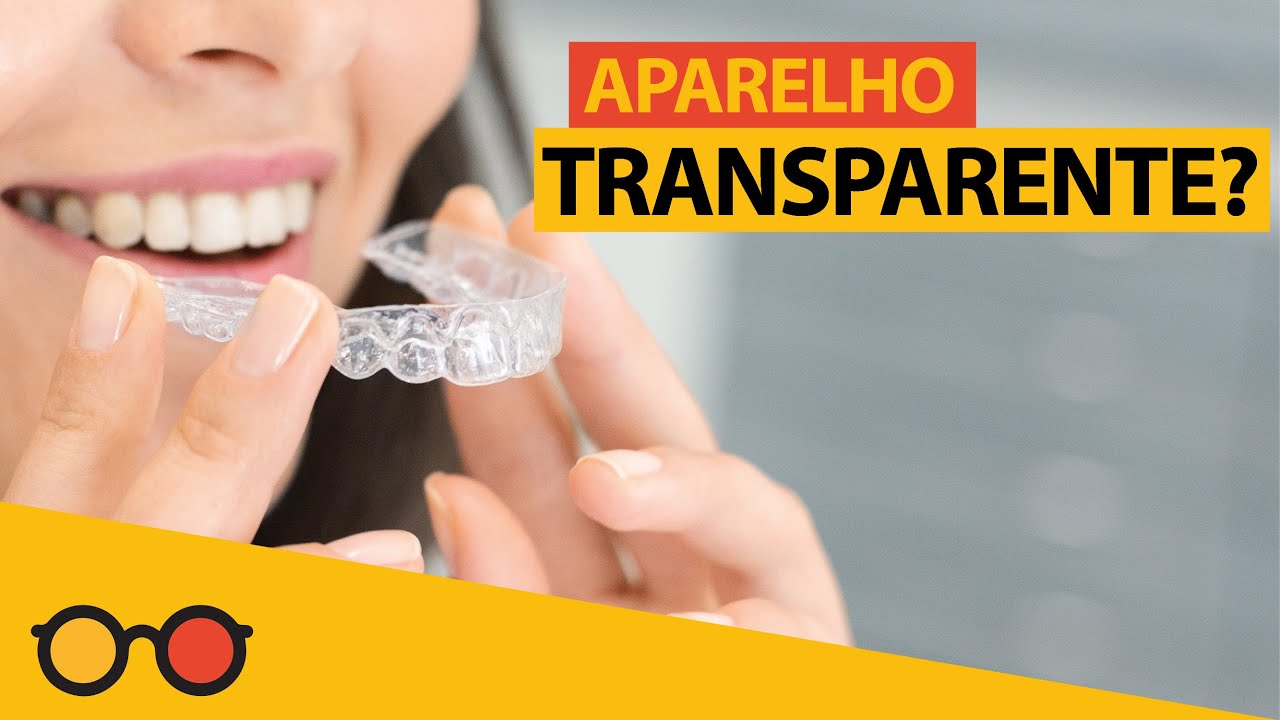 Aparelho transparente é caro?