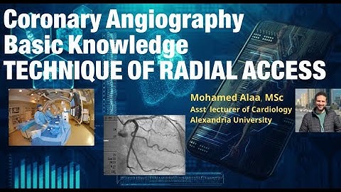 Coronary Angiography Technique (radial access)