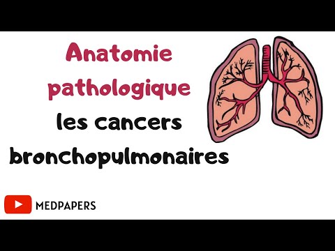 💡Anatomie pathologique : les cancers bronchopulmonaires