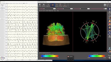 NeuroGuide NeuroNavigator Connectome in Real-Time