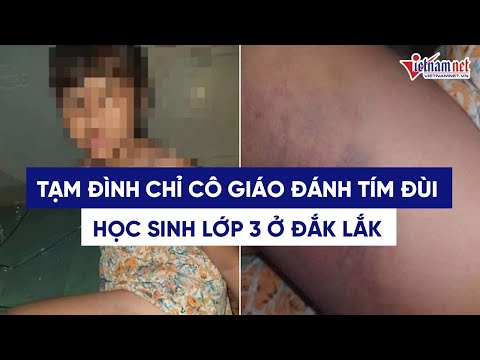 Video Tạm đình chỉ cô giáo đánh tím đùi học sinh lớp 3 vì... - youtube