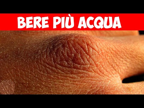 Video: 5 segni Il tuo cane ha bisogno di bere più acqua