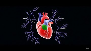 AI Based Medical Segmentation