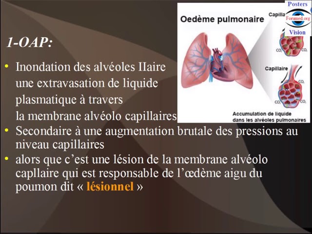 Caveçon Pulmonaire Roma D'occasion - Matériel D'équitation