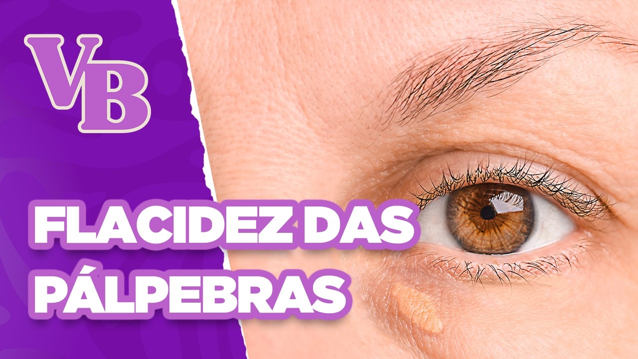 Tratamento para FLACIDEZ das PÁLPEBRAS: Laser de CO2 - Você Bonita (26/08/2025)