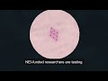 A Cutting-Edge Treatment for Cornea Damage