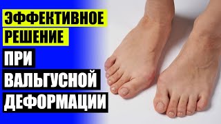 👣 MAGNETFOX НОВЕЙШАЯ МАГНИТНАЯ ВАЛЬГУСНАЯ ШИНА ❕ РАСТЕТ КОСТОЧКА НА ПАЛЬЦЕ НОГИ