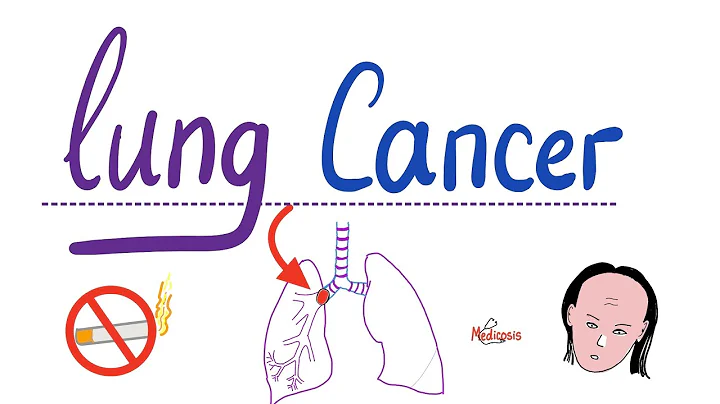 Lung Cancer | The most COMPREHENSIVE Explanation - DayDayNews