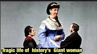 History’s most tragic female ugly giant!