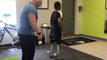 Bilateral Double AK Amputee Running on Prosthetic Legs Blades