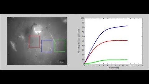 Dendritic Cells on Fibronectin Layer by SEEC Microscopy