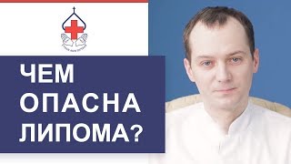 🔎 Что такое липома и как ее лечить. Липома что такое. ГКБ №29 им. Баумана. 12+