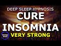 Deep sleep hypnosis to cure insomnia for a deep relaxation very calming hypnosis 2024