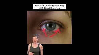 Insomniac anatomy academy 402: red eyes #science #stem #sciencefacts #anatomy #eyes