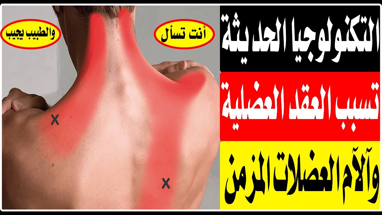 العقد العضلية وآلآم العضلات المزمن بسبب التكنولوجيا الحديثة|ا.د محمد حمادة استاذ علاج الالم