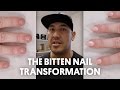 THE BITTEN NAIL TRANSFORMATION (ACRYLIC ENHANCEMENT) - VLOG 21