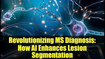 Revolutionizing MS Diagnosis: How AI Enhances Lesion Segmentation