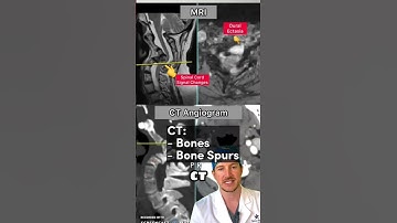 MRI vs CT scan for your back and spine!!