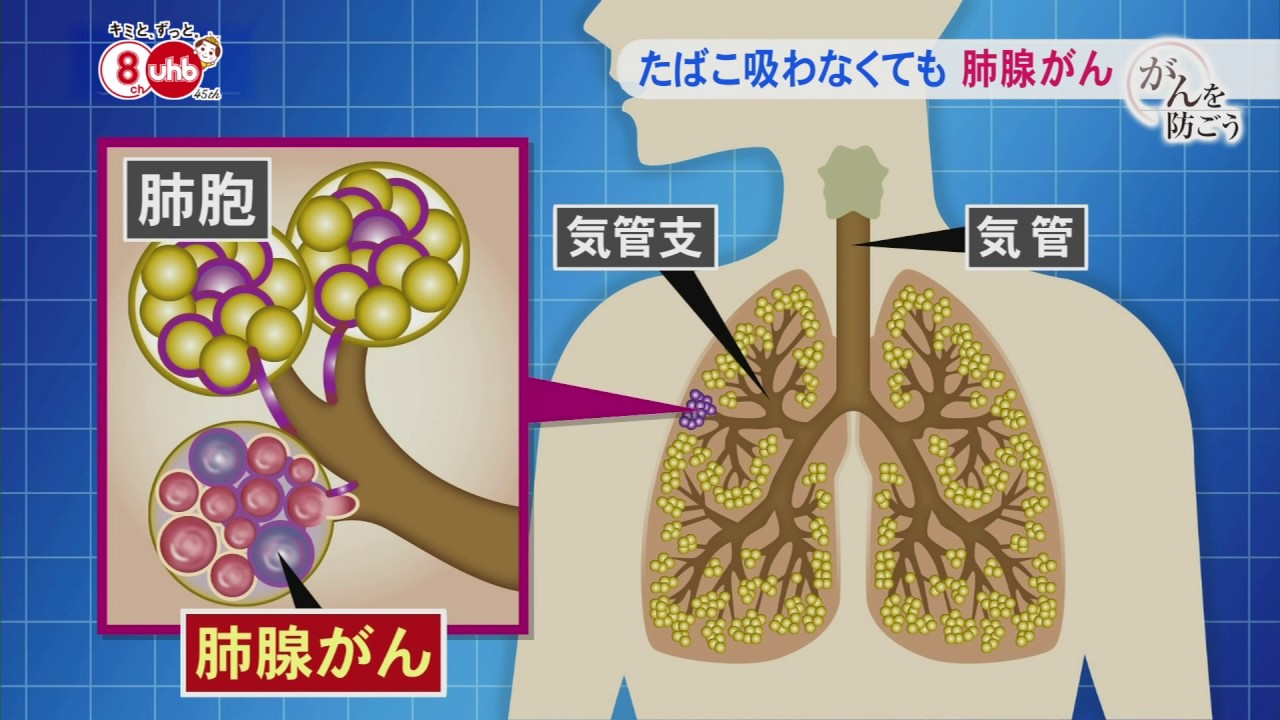 Prevent Cancer - Broadcast on September 29, 2016 [Lung Cancer: No