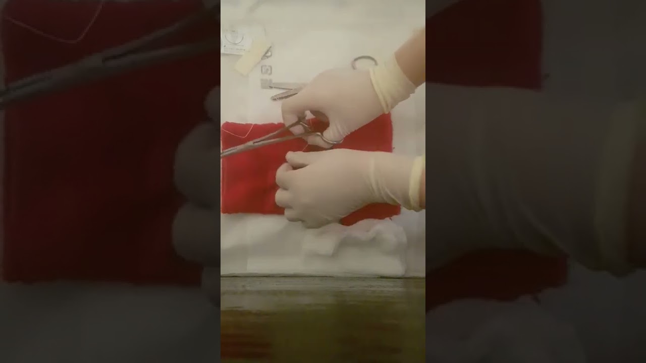 suture d'épisiotomie:plan muqueux