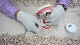 Video 2 RubberDam_Demonstration on Phantom