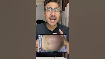 تعديل وضعية الجنين 