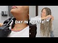 DAY IN MY LIFE| getting kybella injections + new box braids