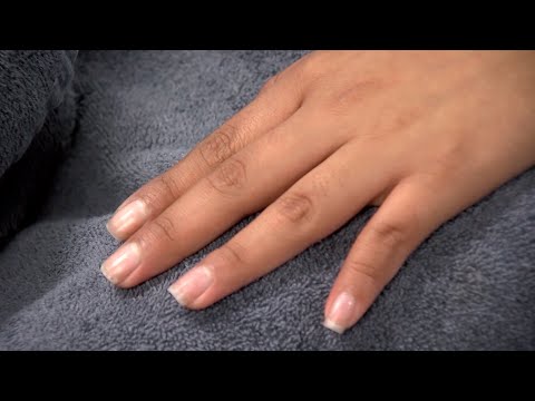 Is It Safe To Get A Gel Manicure With Nail Psoriasis?