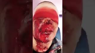 Возможное применение оккупантами химического оружия ,,хлорпикрин’’ на Херсонщине #украина #shorts