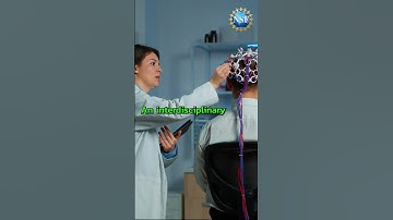 Brain Mapping #shorts