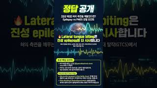 심인성경련, Psychogenic Non Epileptic Seizure, PNES, 소아 응급실