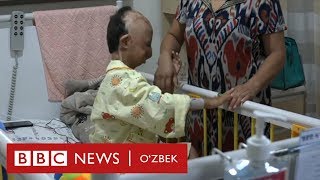 Юзи йўқ ўзбек бола Корея касалхонасида операция қилинди - BBC Uzbek