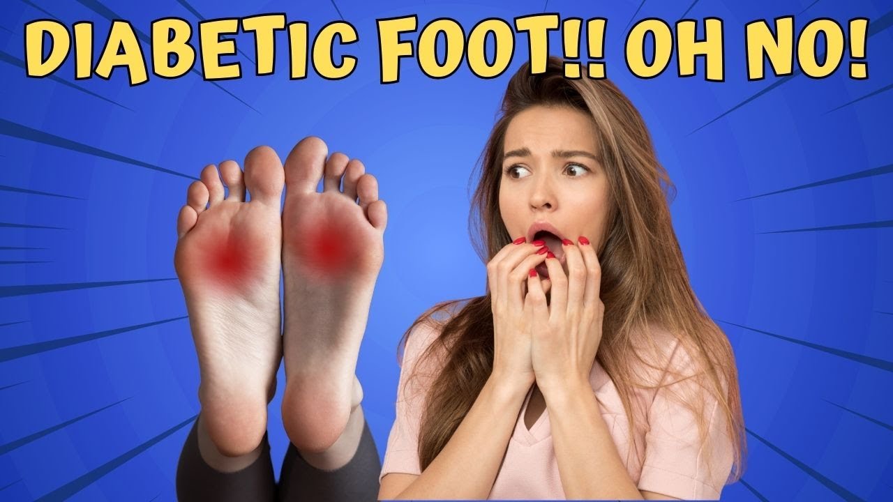 Importance of Foot Care in Diabetes YouTube