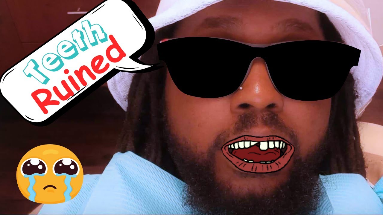 Dental Nightmare The Story Of My Ruined Teeth Now! YouTube