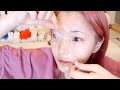 しつこいインスタの広告商品を頼んで使ってみたら皮膚剥がれた【ピーリングオフパック】