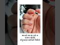 નખ શા માટે ચાવવા ના જોઈએ 😃👌🏻