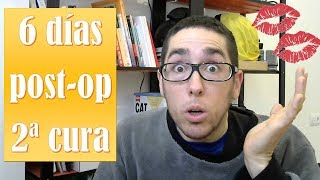 6 días post op. Help, habemus hematomas!!
