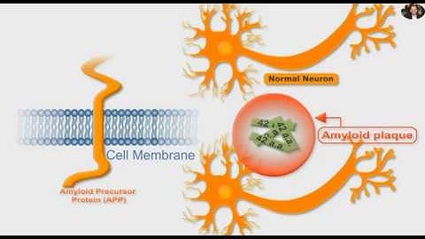 Amyloid Precursor Protein APP, Alzheime  and Gamma secretase