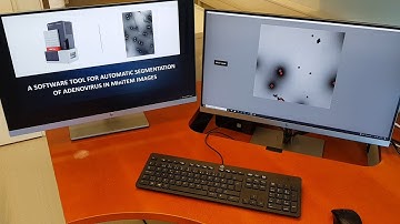 Overview of a Software Tool for Automatic Segmentation of Adenovirus in MiniTEM Images